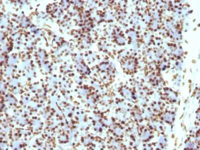 Immunohistochemistry-Paraffin: Histone H1 Antibody (HH1/957) [NBP2-45184]