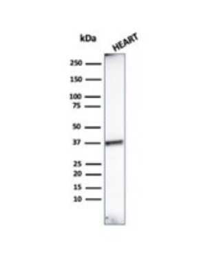 Western Blot: Histone H1 Antibody (HH1/957) [NBP2-45184]