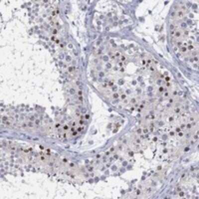 Immunohistochemistry-Paraffin: Histone H1 Antibody [NBP3-17658]