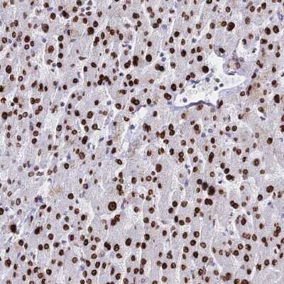 Immunohistochemistry-Paraffin: Histone H1.1 Antibody [NBP2-33402]