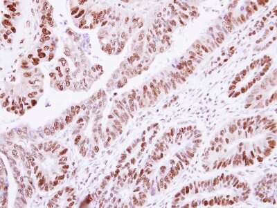 Immunohistochemistry-Paraffin: Histone H1.2 Antibody [NBP2-16845]