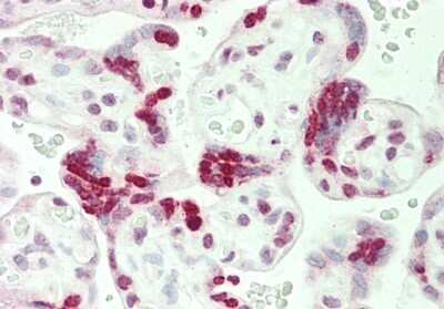 Immunohistochemistry-Paraffin: Histone H1.2 Antibody [NBP2-87570]