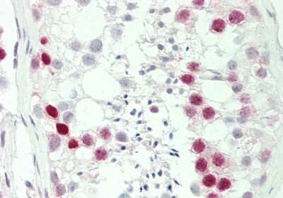 Immunohistochemistry-Paraffin: Histone H1.2 Antibody [NBP2-87570]