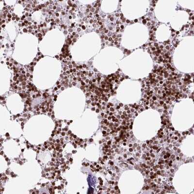 Immunohistochemistry: Histone H1.2 Antibody [NBP2-49202]