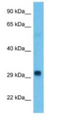 Western Blot: Histone H1.3 Antibody [NBP3-09327]