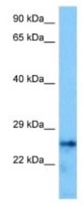 Western Blot: Histone H1.3 Antibody [NBP3-10083]