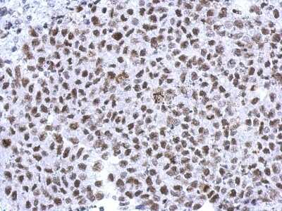 Immunohistochemistry-Paraffin: Histone H1.4 Antibody [NBP2-16847]