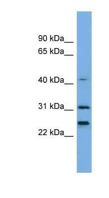 Western Blot: Histone H1.4 Antibody [NBP1-55150]