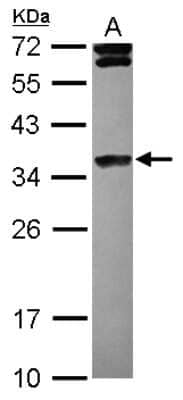 Western Blot: Histone H1.4 Antibody [NBP2-16847]