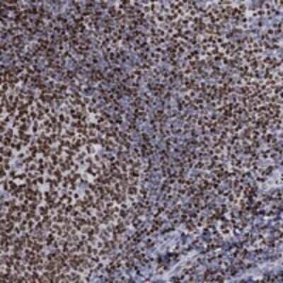 Immunohistochemistry-Paraffin: Histone H1.5 Antibody [NBP3-17162]