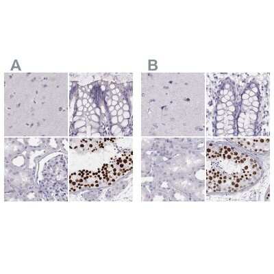 Immunohistochemistry-Paraffin: Histone H1T Antibody [NBP2-56042]