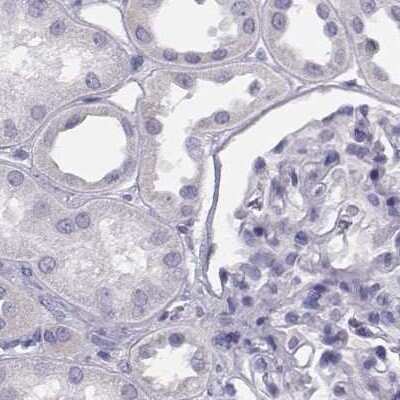 Immunohistochemistry-Paraffin: Histone H1T Antibody [NBP2-56042]