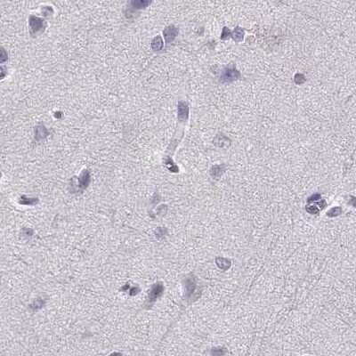 Immunohistochemistry-Paraffin: Histone H1T Antibody [NBP2-56042]
