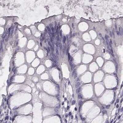 Immunohistochemistry-Paraffin: Histone H1T Antibody [NBP2-56042]