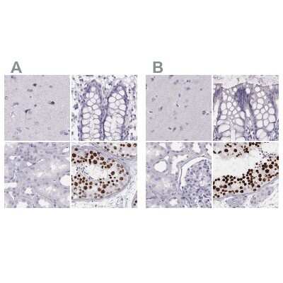 Immunohistochemistry-Paraffin: Histone H1T Antibody [NBP2-57668]