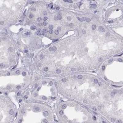 Immunohistochemistry-Paraffin: Histone H1T Antibody [NBP2-57668]