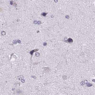Immunohistochemistry-Paraffin: Histone H1T Antibody [NBP2-57668]