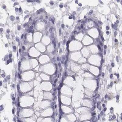 Immunohistochemistry-Paraffin: Histone H1T Antibody [NBP2-57668]