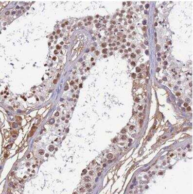 Immunohistochemistry: Histone H1t2 Antibody [NBP2-30774]