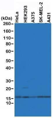 Western Blot: Histone H2A.Z Antibody (RM215) [NBP2-61488]