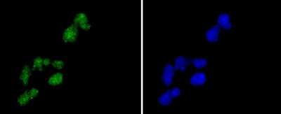 Immunocytochemistry/ Immunofluorescence: Histone H2A.Z Antibody (ST46-09) [NBP2-67499]