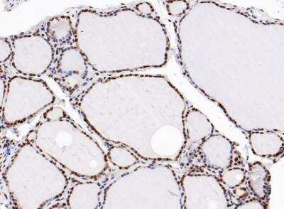 Immunocytochemistry/ Immunofluorescence: Histone H2A.Z Antibody (ST46-09) [NBP2-67499]