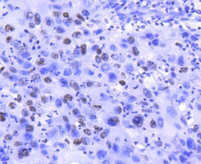 Immunohistochemistry-Paraffin: Histone H2A.Z Antibody (ST46-09) [NBP2-67499]