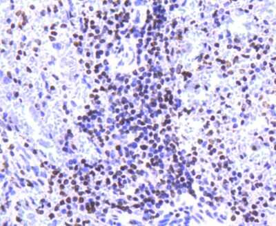 Immunohistochemistry-Paraffin: Histone H2A.Z Antibody (ST46-09) [NBP2-67499]