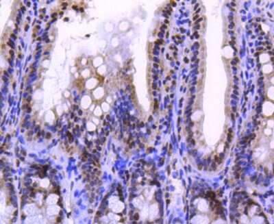 Immunohistochemistry-Paraffin: Histone H2A.Z Antibody (ST46-09) [NBP2-67499]