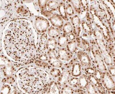 Immunohistochemistry-Paraffin: Histone H2A.Z Antibody (ST46-09) [NBP2-67499]