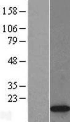 Western Blot: Histone H2A.Z Overexpression Lysate [NBL1-11427]