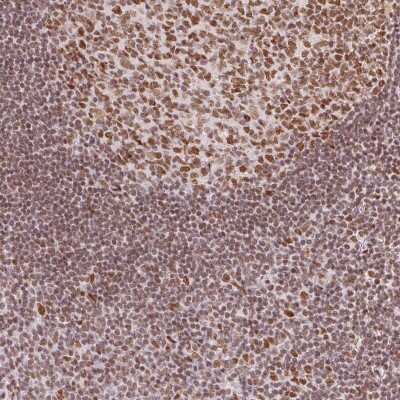 Immunohistochemistry-Paraffin: Histone H2A.Z Antibody [NBP2-58444]