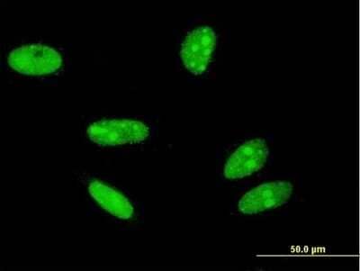 Immunocytochemistry/ Immunofluorescence: Histone H2AX Antibody (3F4) [H00003014-M05]