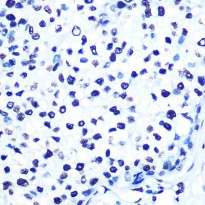 Immunohistochemistry-Paraffin: Histone H2AX Antibody (4Z3S8) [NBP3-15378]