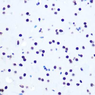 Immunohistochemistry-Paraffin: Histone H2AX Antibody (4Z3S8) [NBP3-15378]
