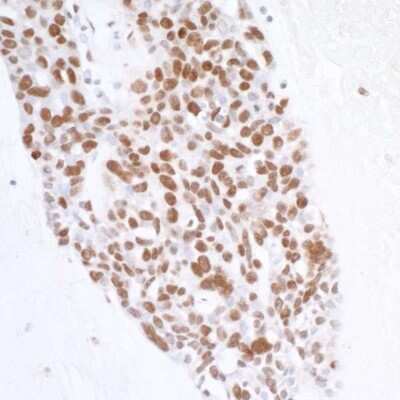 Immunohistochemistry-Paraffin: Histone H2AX Antibody [NB100-383]