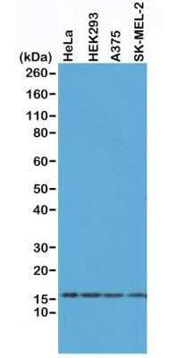 Western Blot: Histone H2AX Antibody (RM214) [NBP3-18534]