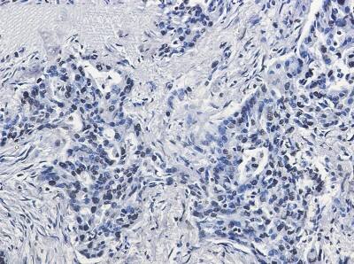 Immunohistochemistry-Paraffin: Histone H2AX Antibody (S02-3C8) [NBP3-20068]