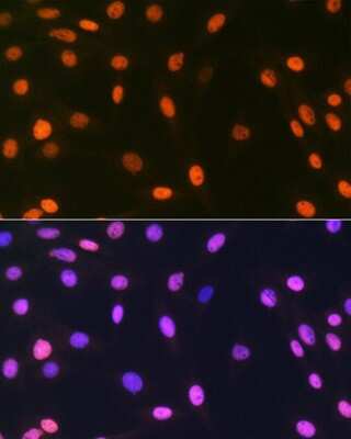 Immunocytochemistry/ Immunofluorescence: Histone H2AY/macroH2A.1 Antibody (4D2O4) [NBP3-16743]