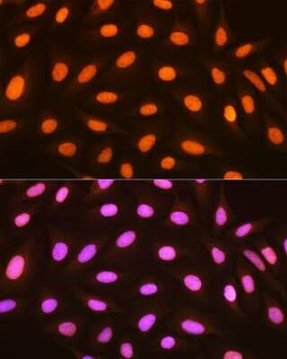 Immunocytochemistry/ Immunofluorescence: Histone H2AY/macroH2A.1 Antibody (4D2O4) [NBP3-16743]