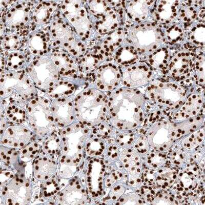 Immunohistochemistry-Paraffin: Histone H2AY/macroH2A.1 Antibody (CL5245) [NBP2-61155]
