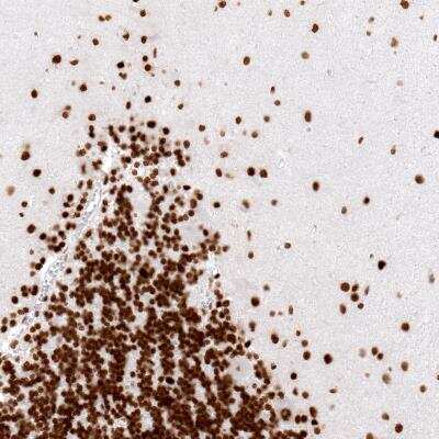 Immunohistochemistry-Paraffin: Histone H2AY/macroH2A.1 Antibody (CL5245) [NBP2-61155]
