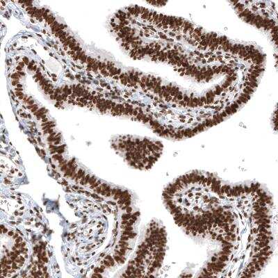 Immunohistochemistry-Paraffin: Histone H2AY/macroH2A.1 Antibody (CL5245) [NBP2-61155]