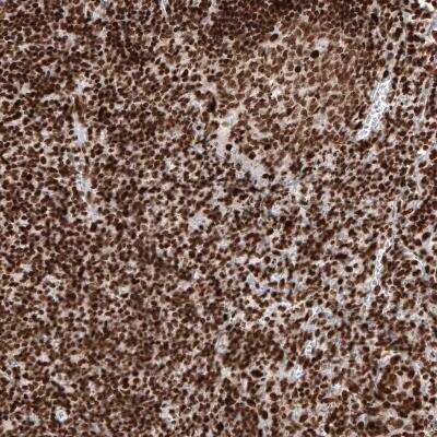 Immunohistochemistry-Paraffin: Histone H2AY/macroH2A.1 Antibody (CL5245) [NBP2-61155]