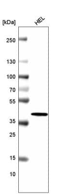 Western Blot: Histone H2AY/macroH2A.1 Antibody (CL5245) [NBP2-61155]