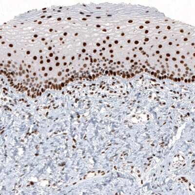 Immunohistochemistry: Histone H2AY/macroH2A.1 Antibody (CL5256) [NBP2-61644]