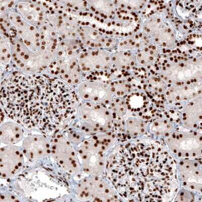 Immunohistochemistry: Histone H2AY/macroH2A.1 Antibody (CL5256) [NBP2-61644]