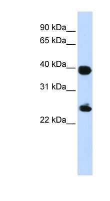 Western Blot: Histone H2AY/macroH2A.1 Antibody [NBP1-53002]