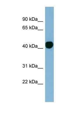 Western Blot: Histone H2AY/macroH2A.1 Antibody [NBP1-53018]