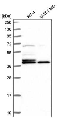 Western Blot: Histone H2AY/macroH2A.1 Antibody [NBP2-56819]